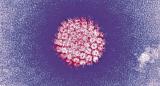 Хуманиот папилома вирус гледан под електронски микроскоп