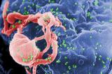 HIV-1 вирусот, обоен зелено, виден под електронски мискроскп