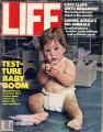 Елизабет Кар, првото американско дете од епрувета на насловната страница на Лајф магазинот 