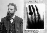 Вилхелм Рентген и првата рентгентска снимка 