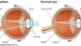Голем дел од знаењата за градбата на окото и причините за некои од нарушувањата на видот му ги должиме на Дондерс