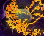 Клетка нападната од коронавирусот SARS-CoV-2. Снимка направена со електронски микроскоп (фото: Викимедија)