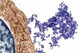 Новата студија ја поврзува мултиплекс склерозата со Епштајн-Бар вирусот, тука прикажан како излегува од Б-клетка