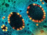 Микрограф од честички на коронавирусот SARS-CoV-2 (обоени во златна боја)
