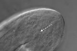 Микроскопска слика на задниот крај на анусот на грината Demodex folliculorum. 