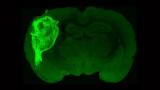 Човечки органоид трансплантиран и набљудуван (благодарение на флуоресцентен протеин) во дел од мозокот на стаорец