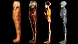 Компјутерската томографија била искористена за виртуелно 'соголување' на мумијата