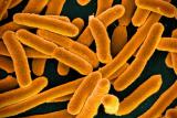 Слика на бактеријата E. coli под микроскоп